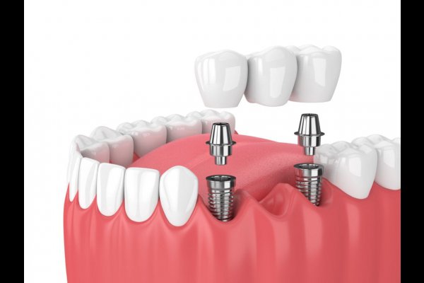 عکس Art Dent Family Dentistry